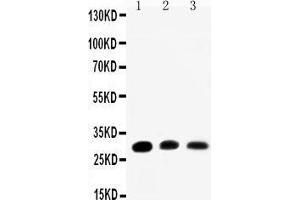 Anti-Aquaporin 1 antibody, Western blotting Lane 1: Rat Kidney Tissue Lysate Lane 2: Rat Lung Tissue Lysate Lane 3: SMMC Cell Lysate (Aquaporin 1 anticorps  (C-Term))