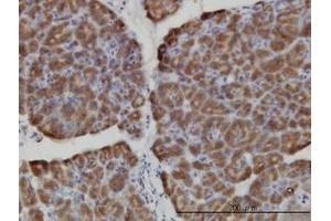 anti-Hect Domain and RLD 3 (HERC3) (AA 1-110) antibody