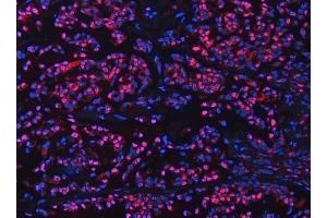 IF analysis of UBC12/UBE2M using anti-UBC12/UBE2M antibody (ABIN7600885). (UBE2M anticorps  (AA 25-154))