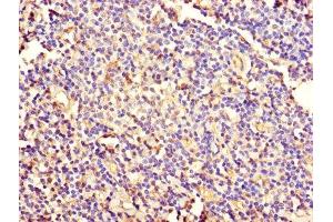 Immunohistochemistry of paraffin-embedded human tonsil tissue using ABIN7157424 at dilution of 1:100 (KRT4 anticorps  (AA 1-534))
