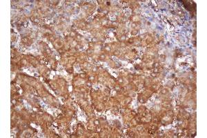 Image no. 2 for anti-Proteasome Subunit alpha 2 (PSMA2) (AA 50-234) antibody (ABIN1491566)