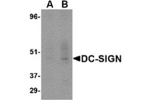 Western Blotting (WB) image for anti-CD209 (CD209) (Extracellular Domain) antibody (ABIN492510) (DC-SIGN/CD209 anticorps  (Extracellular Domain))