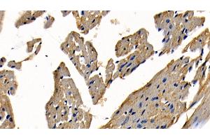 Detection of TRAF6 in Mouse Cardiac Muscle Tissue using Polyclonal Antibody to TNF Receptor Associated Factor 6 (TRAF6)