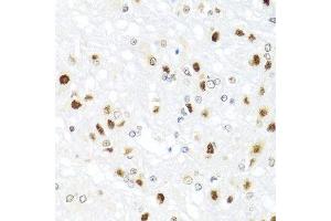 Immunohistochemistry of paraffin-embedded rat brain using GATA2 antibody. (GATA2 anticorps  (AA 1-300))