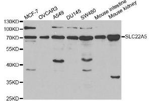 Western blot analysis of extracts of various cell lines, using SLC22A5 antibody. (SLC22A5 anticorps  (AA 1-180))