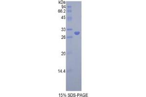 SDS-PAGE analysis of Rat LRPAP1 Protein. (LRPAP1 Protéine)