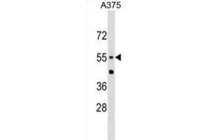Western Blotting (WB) image for anti-Carnosine Dipeptidase 1 (Metallopeptidase M20 Family) (CNDP1) antibody (ABIN2999631)