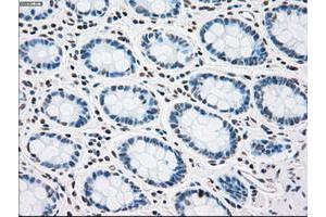 Image no. 2 for anti-Polo-Like Kinase 1 (PLK1) antibody (ABIN1500283)