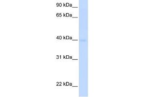 WB Suggested Anti-SLC25A36 Antibody Titration:  0. (SLC25A36 anticorps  (N-Term))