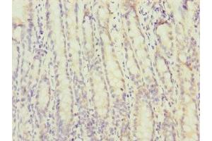 Immunohistochemistry of paraffin-embedded human small intestine tissue using ABIN7172730 at dilution of 1:100 (MTERFD3 anticorps  (AA 1-250))