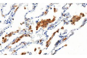 ABIN184738 (5µg/ml) staining of paraffin embedded Human Lung. (Iba1 anticorps  (C-Term))