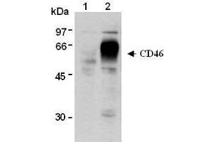 Western Blotting (WB) image for anti-CD46 (CD46) antibody (ABIN1449263)