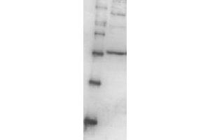 Western Blotting (WB) image for anti-Proteasome (Prosome, Macropain) 26S Subunit, Non-ATPase, 13 (PSMD13) (full length) antibody (ABIN2452116) (PSMD13 anticorps  (full length))