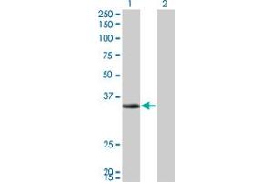 Western Blot analysis of ECH1 expression in transfected 293T cell line by ECH1 monoclonal antibody (M01), clone 5G8.