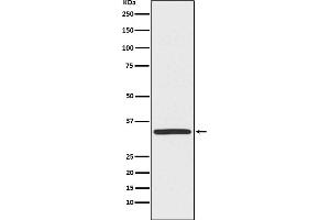 Western blot analysis of TRADD expression in Hela cell lysate.