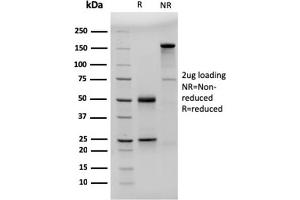 SDS-PAGE Analysis Purified CD23-Monospecific Mouse Monoclonal Antibody (FCER2/3592). (FCER2 anticorps  (AA 48-321))
