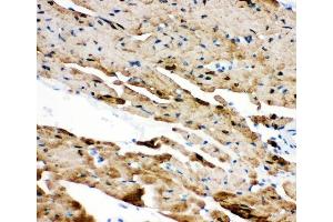 IHC analysis of PLN using anti-PLN antibody (ABIN3043442). (Phospholamban anticorps  (N-Term))