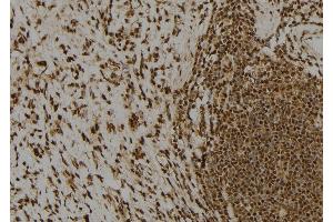 ABIN6260859 and ABIN6277738 at 1/100 staining Human gastric tissue by IHC-P. (Claspin anticorps  (N-Term))