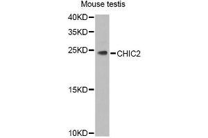 Western blot analysis of extracts of mouse testis, using CHIC2 Antibody (ABIN5974773) at 1/1000 dilution.
