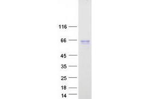 Validation with Western Blot