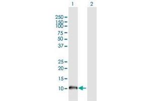 Western Blot analysis of NPHP1 expression in transfected 293T cell line by NPHP1 MaxPab polyclonal antibody.