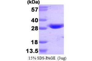 SDS-PAGE (SDS) image for Glutathione S-Transferase theta 1 (GSTT1) (AA 1-240) protein (His tag) (ABIN667119) (GSTT1 Protein (AA 1-240) (His tag))