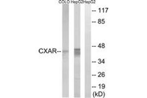 Western blot analysis of extracts from HepG2/COLO cells, using CXADR Antibody. (Coxsackie Adenovirus Receptor anticorps  (AA 1-50))