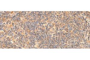 Immunohistochemistry of paraffin-embedded Human tonsil tissue using EIF3K Polyclonal Antibody at dilution of 1:55(x200)