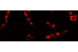 ABIN6274851 staining HuvEc by IF/ICC. (Anosmin anticorps  (Internal Region))