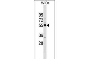 PSMD12 Antibody (Center) (ABIN1881697 and ABIN2838970) western blot analysis in WiDr cell line lysates (35 μg/lane). (PSMD12 anticorps  (AA 276-304))