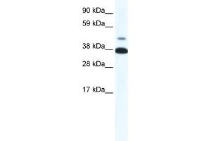 WB Suggested Anti-THRB Antibody Titration:  0.