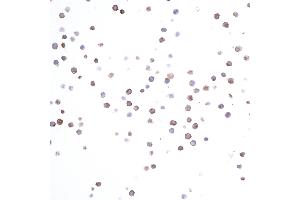 Immunocytochemistry (ICC) image for anti-HLA-DR-gamma (CD74) antibody (ABIN7449435)