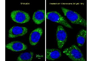 Immunofluorescent analysis of  cells, using ATG16L Antibody (ABIN388542 and ABIN2849682). (ATG16L1 anticorps  (AA 161-190))