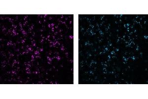 Immunofluorescence analysis of human tonsil frozen section using CD8 (C8/144B, 5 μg/mL) Mouse mAb, labelled with Alexa Fluor® 568 (left, control) and CD8 (3ALB177, 10 μg/mL) monoclonal LIMAAbody®, labelled with Alexa Fluor® 647, on Zeiss Observer 7.