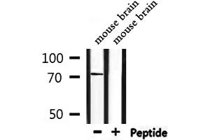 Western blot analysis of extracts from mouse  brain, using SLC6A8 Antibody.