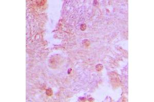 Immunohistochemical analysis of AS160 (pT642) staining in human brain formalin fixed paraffin embedded tissue section.