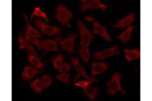 ABIN6276267 staining HeLa by IF/ICC. (OR5M1/5M10 anticorps)