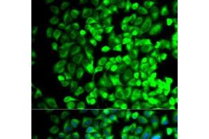 Immunofluorescence analysis of HeLa cells using TBXAS1 Polyclonal Antibody (TBXAS1 anticorps)