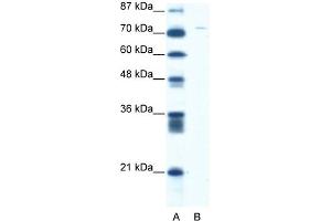 WB Suggested Anti-ASPH Antibody Titration:  5. (Aspartate beta Hydroxylase anticorps  (Middle Region))
