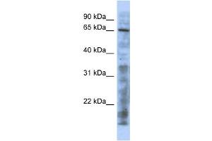 WB Suggested Anti-HTATIP Antibody Titration:  0. (KAT5 anticorps  (N-Term))