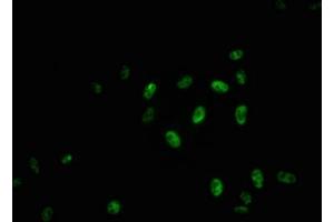 Immunofluorescence staining of Hela cells with ABIN7127716 at 1:100,counter-stained with DAPI. (Recombinant MYB anticorps  (pSer11))