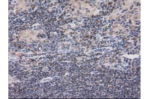 Image no. 11 for anti-Catalase (CAT) antibody (ABIN1497109)