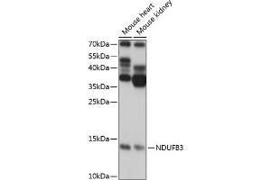 Western blot analysis of extracts of various cell lines, using NDUFB3 antibody (ABIN7268810) at 1:1000 dilution. (NDUFB3 anticorps  (AA 1-98))