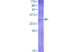 Prokineticin 2 (PROK2) (AA 20-108) protein (GST tag)