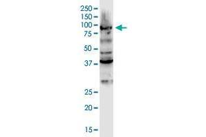 DCLK3 monoclonal antibody (M01), clone 2B1. (DCLK3 anticorps  (AA 175-284))