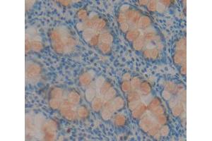 IHC-P analysis of rectum tissue, with DAB staining. (HABP2 anticorps  (AA 24-560))
