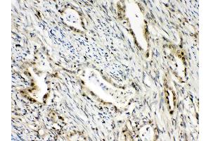 IHC analysis of RanBP1 using anti- RanBP1 antibody .