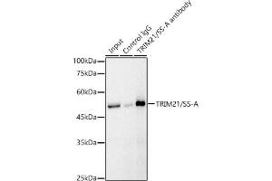 Immunoprecipitation analysis of 300 μg extracts of Jurkat cells using 3 μg TRIM21/SS-A Rabbit antibody (ABIN6131376, ABIN6149506, ABIN6149507 and ABIN6217587). (TRIM21 anticorps  (AA 80-330))