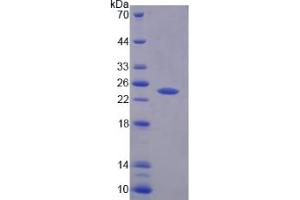 SDS-PAGE (SDS) image for Protein tyrosine Phosphatase, Receptor Type, N Polypeptide 2 (PTPRN2) (AA 839-1015) protein (His tag) (ABIN6239396) (PTPRN2 Protein (AA 839-1015) (His tag))