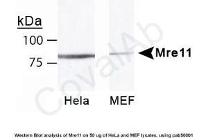Mre11 anticorps